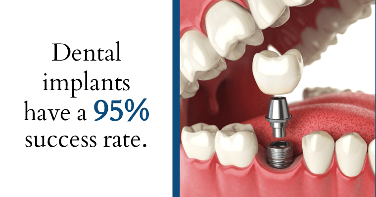 Dental implants have a 95% success rate.