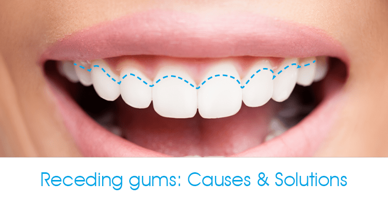 What Causes Receding Gums?