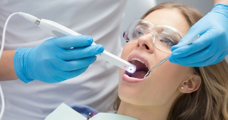 intra-oral camera used to digitally scan teeth for CEREC same-day crowns