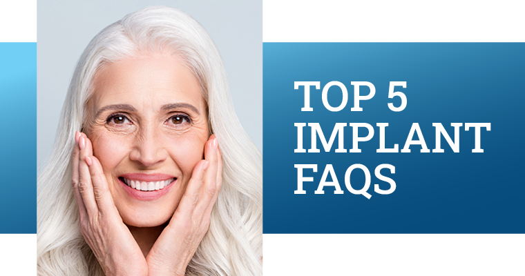 Top 5 Dental Implant FAQ