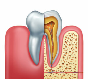 An image showing the inside of a tooth and the root system